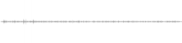 audio waveform