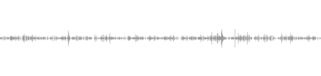 audio waveform