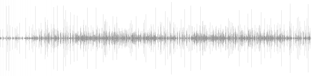 audio waveform