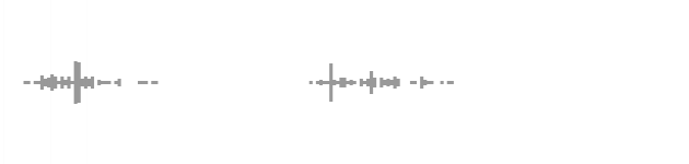 audio waveform