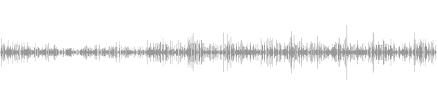 audio waveform