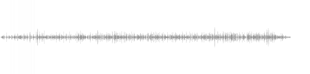 audio waveform