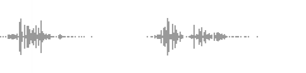audio waveform
