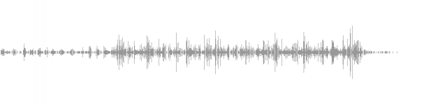 audio waveform