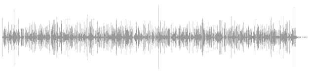audio waveform