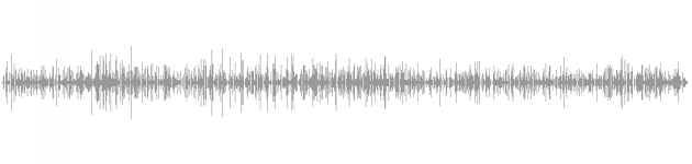 audio waveform