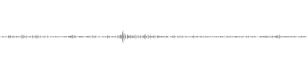 audio waveform