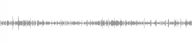audio waveform