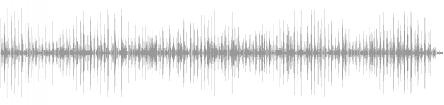 audio waveform