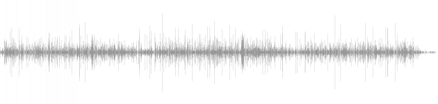 audio waveform