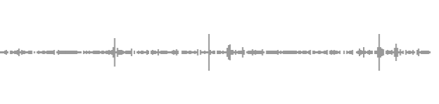 audio waveform