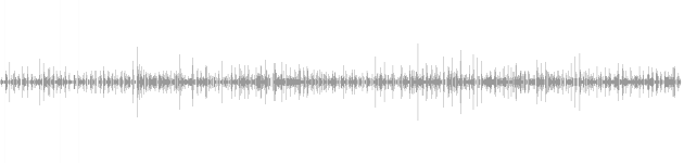 audio waveform
