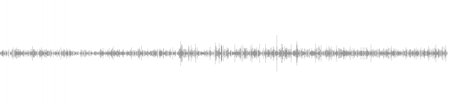 audio waveform