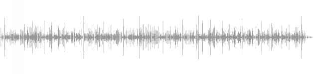 audio waveform