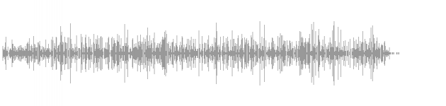 audio waveform